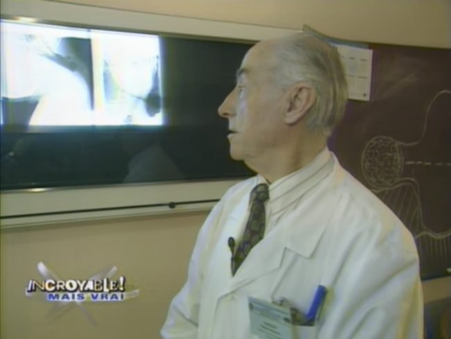 Alexander’s doctor has never seen anything quite like it in his decades of practice and says that Alexander’s condition is a congenital trait. As it turns out, getting into gymnastics just helped him express the trait. It didn't cause it.