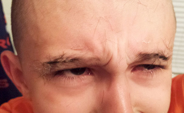 "My kid decided to trim his eyebrows. When he cut them too short he decided to cut hair from his head and glue it to his eyebrows. He immediately regretted his decision." - leeto86