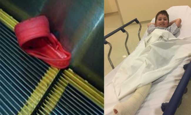 He lost his big toe, and the entire ligament that extends from the big toe to the calf was pulled out. Wood calls these "life-changing injuries" and notes that he will need more surgeries in the coming months.