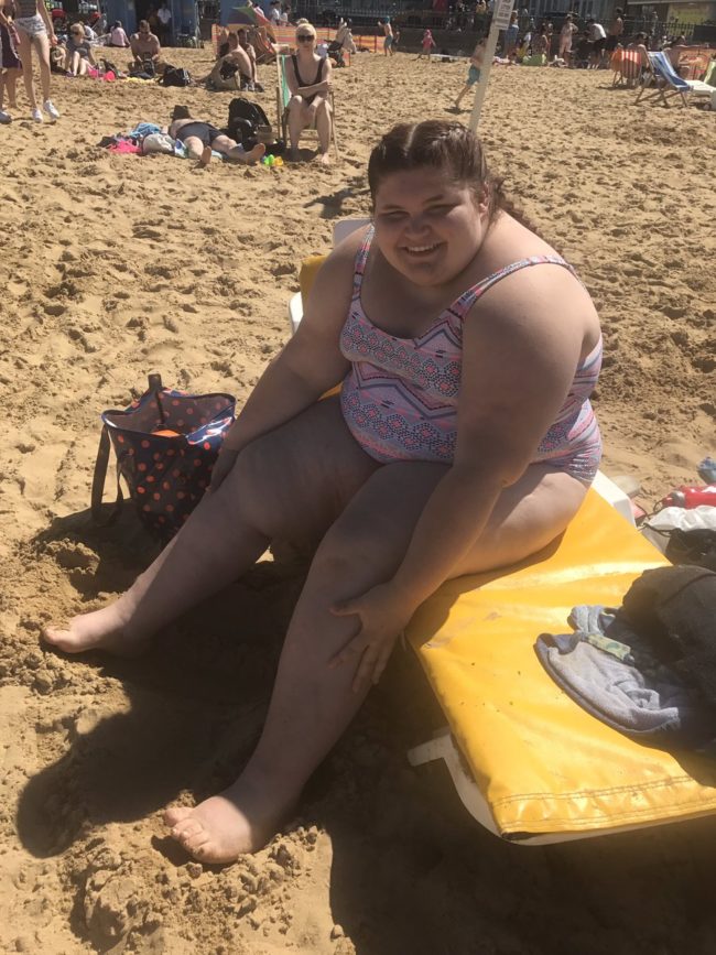 Because of her metabolic condition, she gains weight very easily and has a lot of difficulty losing it. She was also born with hip dysplasia, making her left leg shorter than the right. Because of the pins in her joint, she walks with a limp, which bullies have also pointed out and mocked.