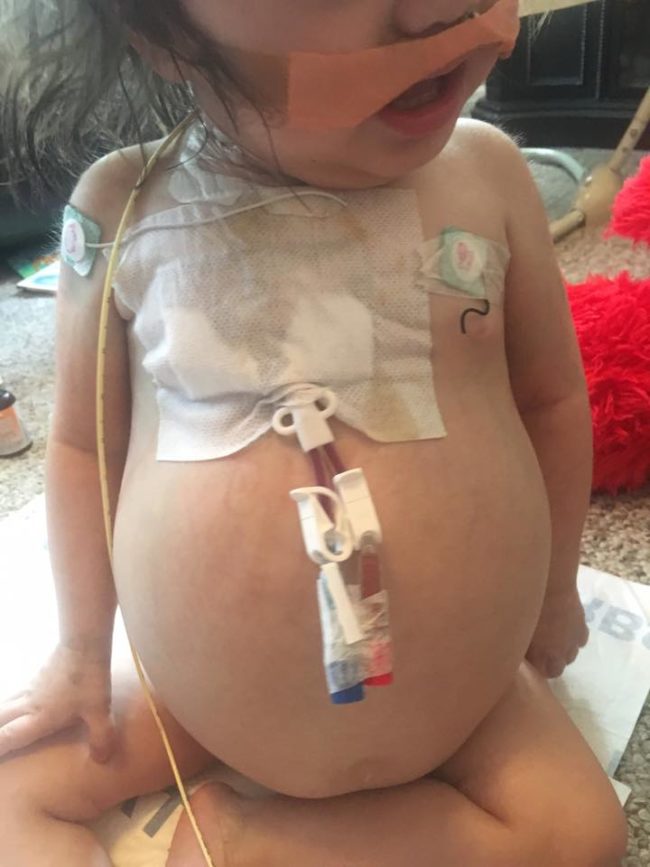 When she was about a year and a half old, her kidneys unfortunately started to fail. Her prognosis wasn't good.
