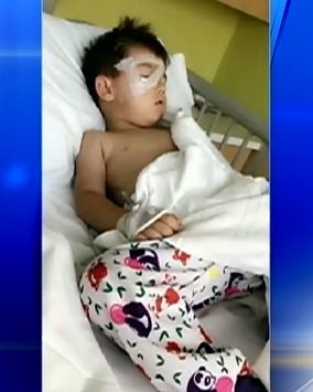 The glass hit Spencer directly in the face, leaving him with a cut on his forehead and a punctured eye. According to his mom, Samantha Upson, he's had to undergo surgery and had to visit a specialist earlier this week. She doesn't know yet whether her son will lose any of his vision.