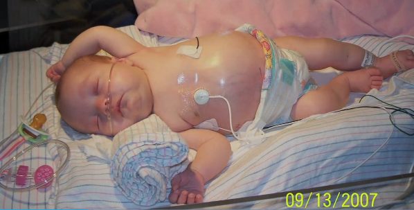 When the Dunns took her to the Children’s Hospital of Michigan for testing, one doctor saw Isabelle and asked permission to do an ultrasound. As it turned out, she was also suffering from the same form of cancer.