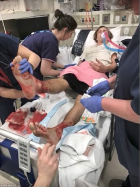 Sea lice feed on mucus, blood, and tissue of host fish, but marine biologists say they've never seen anything this vicious or immediate before in humans.