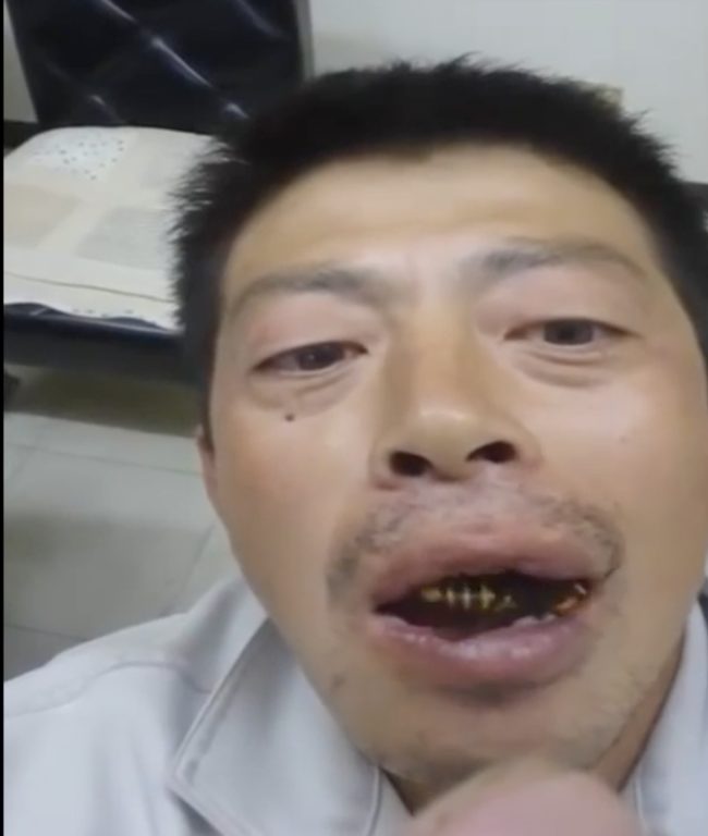 But in a matter of seconds there’s a strange buzzing noise coming from the man’s mouth.