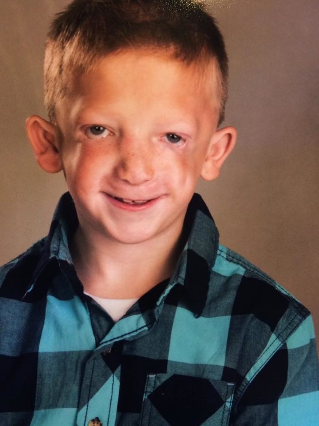 Because of his unique looks, Jackson has had to put up with a lot of bullying from his classmates. It's gotten so bad that at seven years old, he's considered suicide.