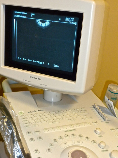 In the months prior to conceiving her child, Zhang underwent surgery to remove non-cancerous fibroids from her uterus.