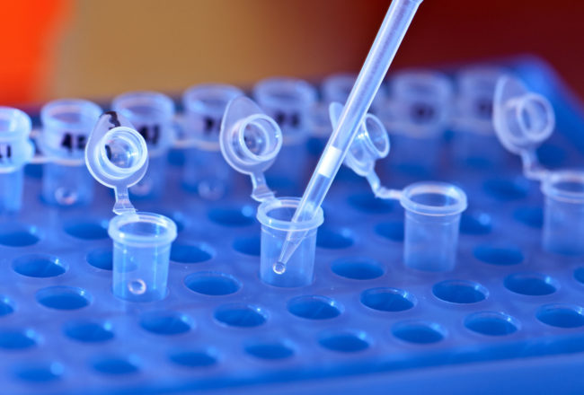 "In my genetics class we do a blood typing lab and our teacher told a story about her first year doing it where there was a girl who had a blood type that meant her dad couldn’t be her actual father and the mom (who also worked at the school) got caught cheating." -- Xzeener