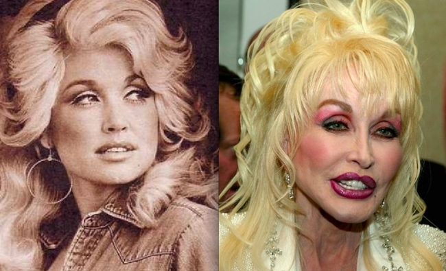 Dolly Parton might be more plastic than human at this point.