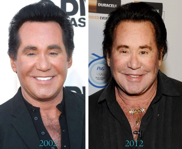 Vegas living has done nothing good for Wayne Newton.