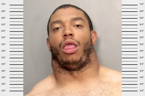 26. A doctor might want to look at his throat sometime soon.